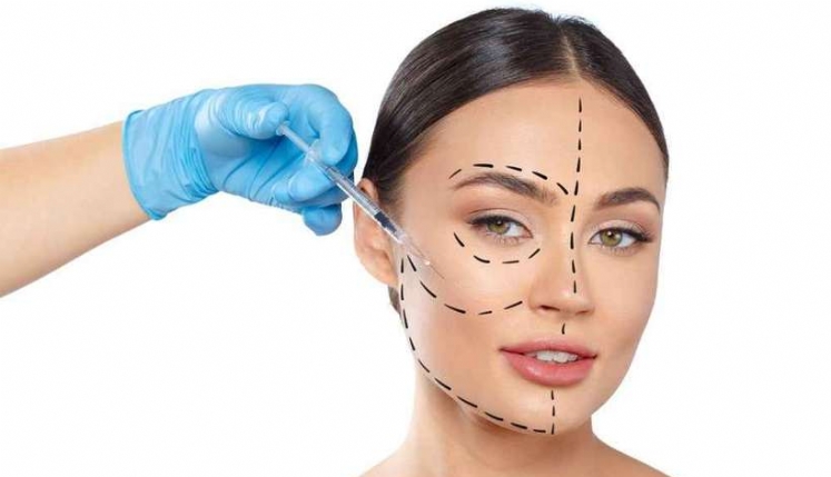 You are currently viewing HARMONIZAÇÃO FACIAL